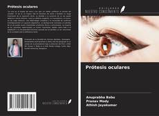 Bookcover of Prótesis oculares