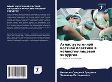 Bookcover of Атлас аутогенной костной пластики в челюстно-лицевой хирургии