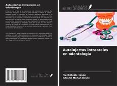 Buchcover von Autoinjertos intraorales en odontología