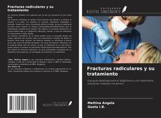 Bookcover of Fracturas radiculares y su tratamiento