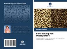 Behandlung von Osteoporose的封面