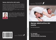 Bookcover of Apnea obstructiva del sueño