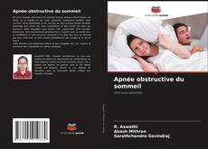 Capa do livro de Apnée obstructive du sommeil 