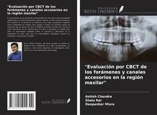Bookcover of "Evaluación por CBCT de los forámenes y canales accesorios en la región maxilar"