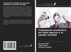 Bookcover of Tratamiento ortodóntico del labio leporino y el paladar hendido