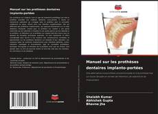 Capa do livro de Manuel sur les prothèses dentaires implanto-portées 