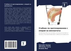 Copertina di Учебник по протезированию с опорой на имплантаты