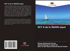 Bookcover of OCT A de la NAION aiguë