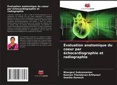 Bookcover of Évaluation anatomique du coeur par échocardiographie et radiographie