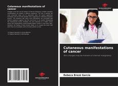 Bookcover of Cutaneous manifestations of cancer
