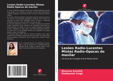 Обложка Lesões Radio-Lucentes Mistas Radio-Opacas do maxilar