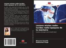 Buchcover von Lésions mixtes radio-lucides radio-opaques de la mâchoire