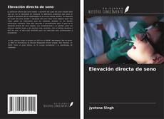 Buchcover von Elevación directa de seno
