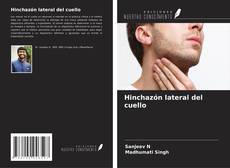 Bookcover of Hinchazón lateral del cuello