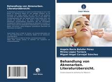 Behandlung von Aknenarben. Literaturübersicht. kitap kapağı