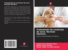 Capa do livro de Tratamento de cicatrizes de acne. Revisão literária. 