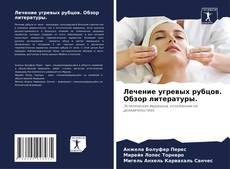 Bookcover of Лечение угревых рубцов. Обзор литературы.