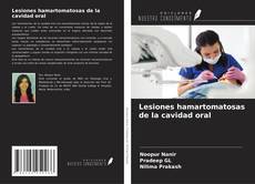 Bookcover of Lesiones hamartomatosas de la cavidad oral