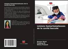 Bookcover of Lésions hamartomateuses de la cavité buccale