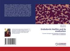 Buchcover von Endodontic biofilm and its eradication