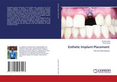 Copertina di Esthetic Implant Placement