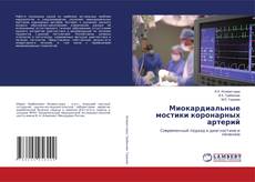 Copertina di Миокардиальные мостики коронарных артерий