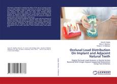Copertina di Occlusal Load Distribution On Implant and Adjacent Natural Teeth