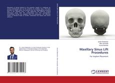 Copertina di Maxillary Sinus Lift Procedures