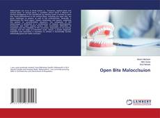 Copertina di Open Bite Malocclsuion