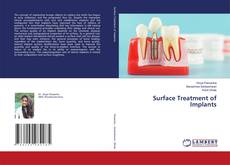 Copertina di Surface Treatment of Implants