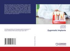 Copertina di Zygomatic Implants