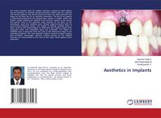 Copertina di Aesthetics in Implants