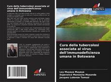 Buchcover von Cura della tubercolosi associata al virus dell'immunodeficienza umana in Botswana