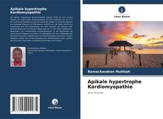 Couverture de Apikale hypertrophe Kardiomyopathie