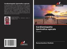 Bookcover of Cardiomiopatia ipertrofica apicale