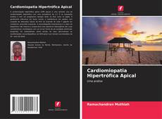 Buchcover von Cardiomiopatia Hipertrófica Apical