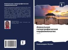 Couverture de Апикальная гипертрофическая кардиомиопатия