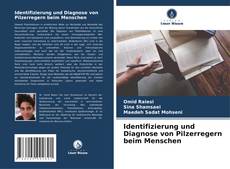 Identifizierung und Diagnose von Pilzerregern beim Menschen kitap kapağı