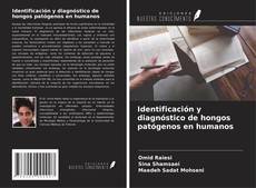 Buchcover von Identificación y diagnóstico de hongos patógenos en humanos