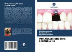 Portada del libro de IMPLANTATE UND IHRE BEHANDLUNG