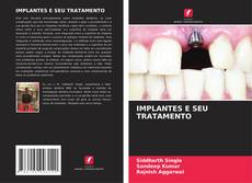 Buchcover von IMPLANTES E SEU TRATAMENTO