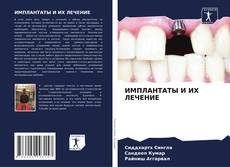 Capa do livro de ИМПЛАНТАТЫ И ИХ ЛЕЧЕНИЕ 