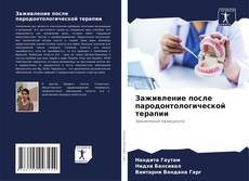 Capa do livro de Заживление после пародонтологической терапии 