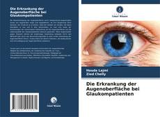 Bookcover of Die Erkrankung der Augenoberfläche bei Glaukompatienten