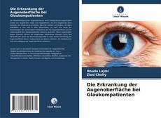 Buchcover von Die Erkrankung der Augenoberfläche bei Glaukompatienten