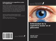 Buchcover von Enfermedad de la superficie ocular en el glaucoma