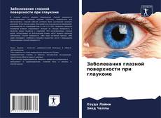 Bookcover of Заболевания глазной поверхности при глаукоме