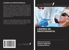 Bookcover of LÁSERES EN PROSTODONCIA