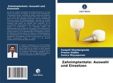 Portada del libro de Zahnimplantate: Auswahl und Einsetzen