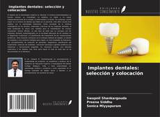 Portada del libro de Implantes dentales: selección y colocación